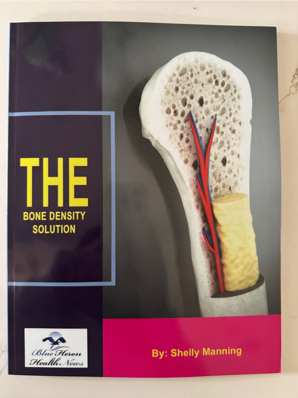 The Bone Density Solution Soft cover Book By Shelley Mannings